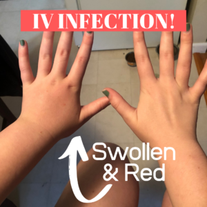 IV Infection Image